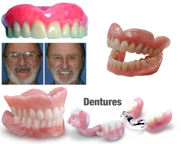 Dentures