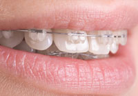 Orthodontics